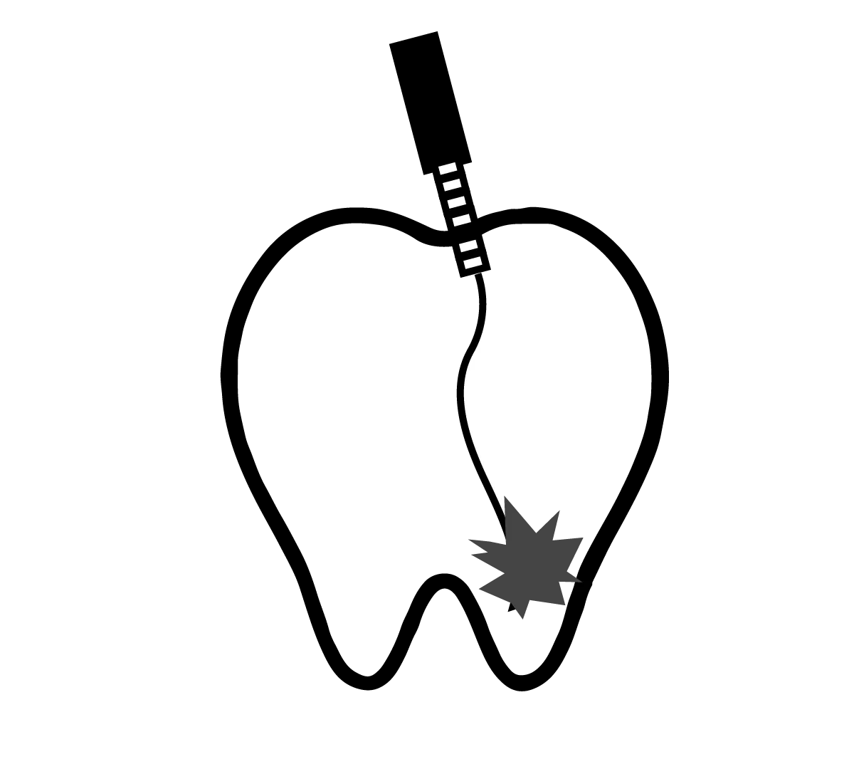 根管治療のロゴマーク